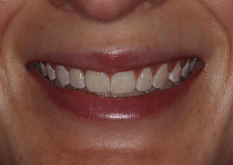 Konig Center for Cosmetic & Comprehensive Dentistry smile photos